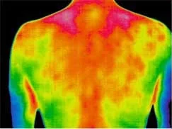 Mappa termografica della schiena per individuare aree di sovraccarico